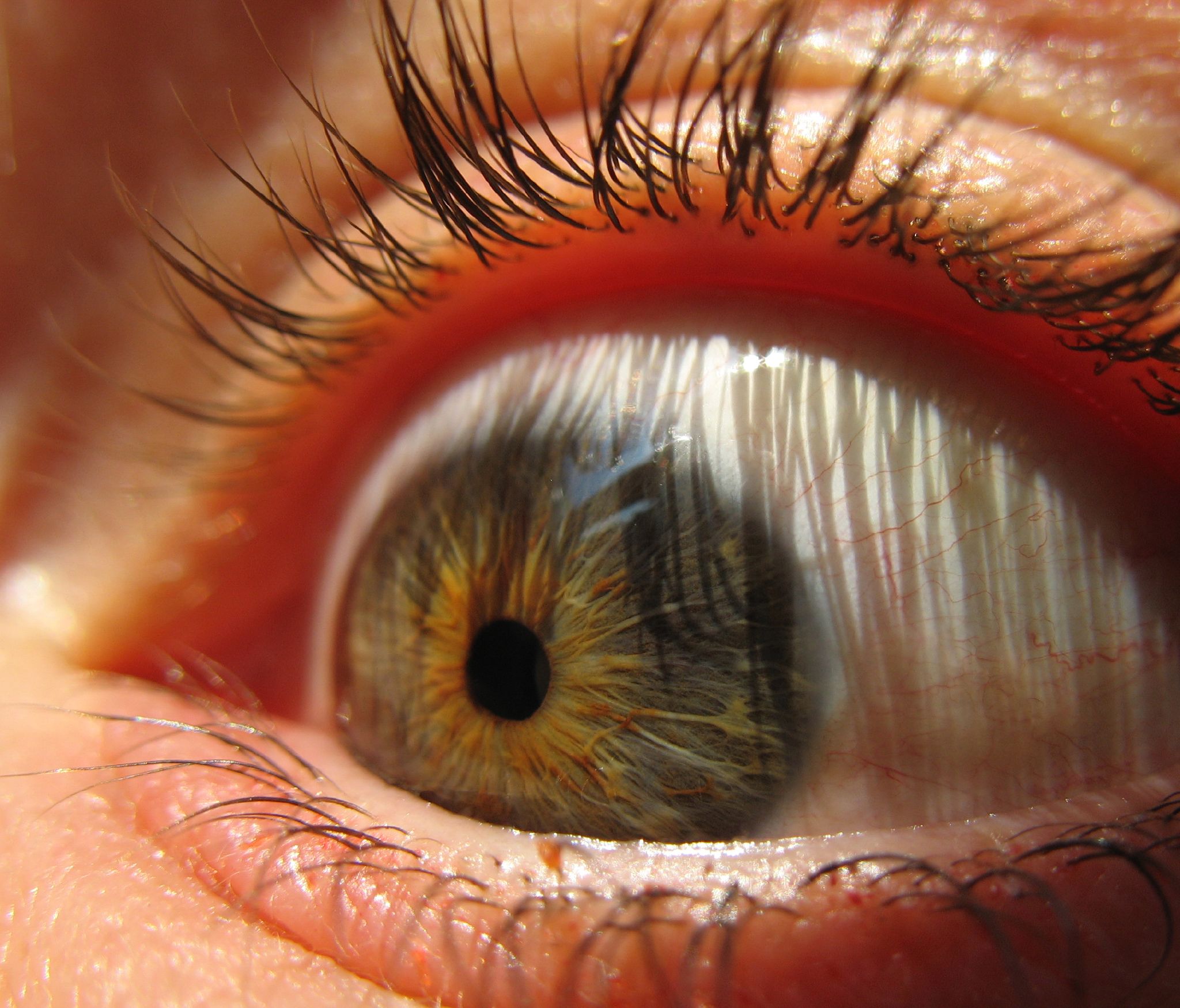 Eyeball_(sugarpond).jpg